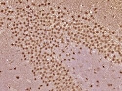 VHLH Rabbit anti-Human, Polyclonal, Bioss 100 &mu;L; Unconjugated:Antibodies,