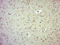 Phospho-LATS1 (Thr1079) Rabbit anti-Human, Polyclonal, Bioss 100 &mu;L;