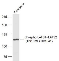 Phospho-LATS1 (Thr1079) Rabbit anti-Human, Polyclonal, Bioss 100 &mu;L;