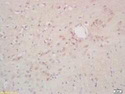 Phospho-NK (Thr234) Rabbit anti-Human, Polyclonal, Bioss 100 &mu;L | Buy Online | Bioss | Fisher Scientific