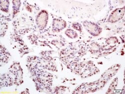 CCDC7 Rabbit anti-Human, Polyclonal, Bioss 100 &mu;L; Unconjugated:Antibodies,