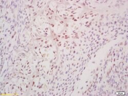 Phospho-DDX5 (Tyr593) Rabbit anti-Human, Polyclonal, Bioss 100 &mu;L; Unconjugated:Antibodies,