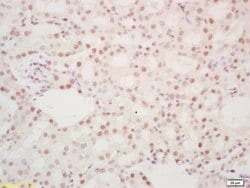 Phospho-DDX5 (Tyr593) Rabbit anti-Human, Polyclonal, Bioss 100 &mu;L; Unconjugated:Antibodies,