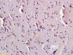 CEMIP Rabbit anti-Human, Polyclonal, Bioss 100 &mu;L; Unconjugated:Antibodies,