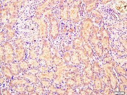 CEMIP Rabbit anti-Human, Polyclonal, Bioss 100 &mu;L; Unconjugated:Antibodies,