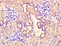 CEMIP Rabbit anti-Human, Polyclonal, Bioss 100 &mu;L; Unconjugated:Antibodies,