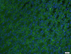 ADCK4 Rabbit anti-Human, Polyclonal, Bioss 100 &mu;L | Buy Online | Bioss | Fisher Scientific