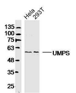 UMPS Rabbit anti-Human, Polyclonal, Bioss 100 &mu;L; Unconjugated:Antibodies,