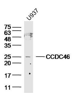 CCDC46 Rabbit anti-Human, Polyclonal, Bioss 100 &mu;L; Unconjugated:Antibodies,