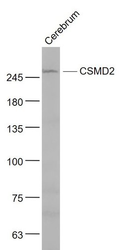 CSMD2 Rabbit anti-Human, Polyclonal, Bioss 100 &mu;L; Unconjugated:Antibodies,