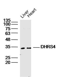 DHRS4 Rabbit anti-Human, Polyclonal, Bioss 100 &mu;L; Unconjugated:Antibodies,