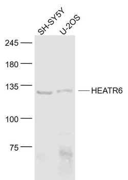 HEATR6 Rabbit anti-Human, Polyclonal, Bioss 100 &mu;L | Buy Online | Bioss | Fisher Scientific