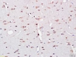 UBE2Q1 Rabbit anti-Human, Polyclonal, Bioss 100 &mu;L; Unconjugated:Antibodies,