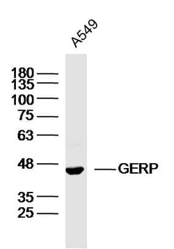BXDC2 Rabbit anti-Human, Polyclonal, Bioss 100 &mu;L | Buy Online | Bioss | Fisher Scientific