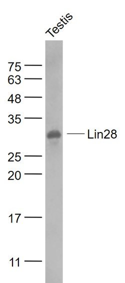 Lin28A/B Rabbit anti-Human Mouse Rat, Polyclonal, Bioss 100 &mu;L; Unconjugated:Antibodies,