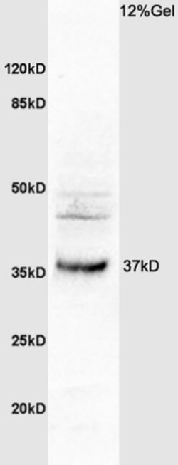 OSTM1 Rabbit anti-Human, Polyclonal, Bioss 100 &mu;L; Unconjugated:Antibodies,