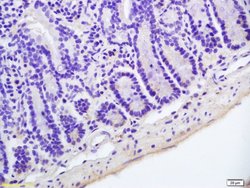 Hairless Polyclonal Antibody, Bioss 100 &mu;L | Buy Online | Bioss | Fisher Scientific
