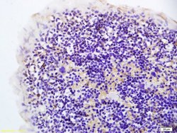 Hairless Polyclonal Antibody, Bioss 100 &mu;L | Buy Online | Bioss | Fisher Scientific