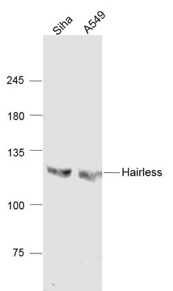 Hairless Polyclonal Antibody, Bioss 100 &mu;L | Buy Online | Bioss | Fisher Scientific