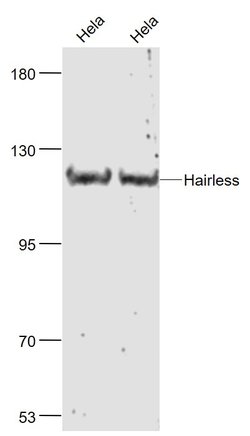 Hairless Polyclonal Antibody, Bioss 100 &mu;L | Buy Online | Bioss | Fisher Scientific