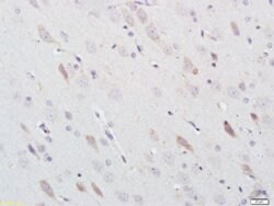Nitrotyrosine Rabbit anti-Human, Polyclonal, Bioss 100 &mu;L; Unconjugated:Antibodies,