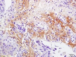 Laminin 2 alpha Rabbit anti-Human, Polyclonal, Bioss 100 &mu;L; Unconjugated:Antibodies,