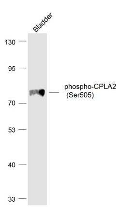 Phospho-CPLA2 (Ser505) Rabbit anti-Human, Polyclonal, Bioss 100 &mu;L;