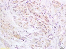 PXMP1 Rabbit anti-Human, Polyclonal, Bioss 100 &mu;L; Unconjugated:Antibodies,