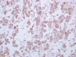 Arginase 1 Rabbit anti-Human, Polyclonal, Bioss 100 &mu;L; Unconjugated:Antibodies,