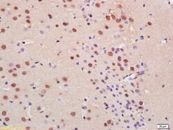 C9orf72 Rabbit anti-Human, Polyclonal, Bioss 100 &mu;L; Unconjugated:Antibodies,