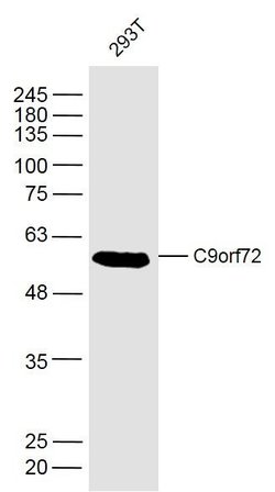 C9orf72 Rabbit anti-Human, Polyclonal, Bioss 100 &mu;L; Unconjugated:Antibodies,