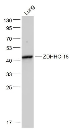 ZDHHC-18 Rabbit anti-Human, Polyclonal, Bioss 100 &mu;L; Unconjugated:Antibodies,