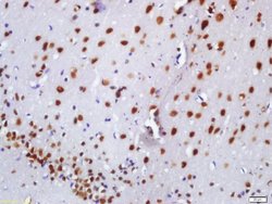 BASP1 Rabbit anti-Human, Polyclonal, Bioss 100 &mu;L; Unconjugated:Antibodies,