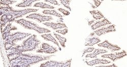 p53 FL-393 Rabbit anti-Human, Polyclonal, Bioss 100 &mu;L; Unconjugated:Antibodies,