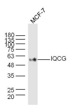 IQCG Rabbit anti-Human, Polyclonal, Bioss 100 &mu;L; Unconjugated:Antibodies,