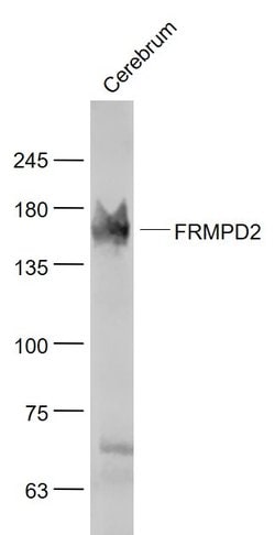 PDZK4 Rabbit anti-Human, Polyclonal, Bioss 100 &mu;L; Unconjugated:Antibodies,