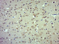 TRPM4 Rabbit anti-Human, Polyclonal, Bioss 100 &mu;L; Unconjugated:Antibodies,