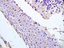 Phospho-DVL2 (Thr224) Rabbit anti-Human, Polyclonal, Bioss 100 &mu;L; Unconjugated:Antibodies,