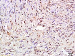 ATAD2 Rabbit anti-Human, Polyclonal, Bioss 100 &mu;L; Unconjugated:Antibodies,