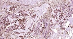 ATAD2 Rabbit anti-Human, Polyclonal, Bioss 100 &mu;L; Unconjugated:Antibodies,