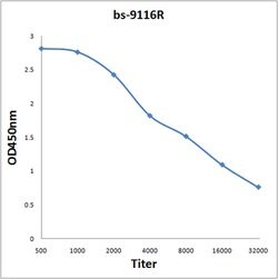 BAGE4 Rabbit anti-Human, Polyclonal, Bioss 100 &mu;L; Unconjugated:Antibodies,