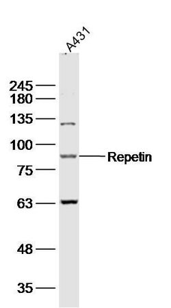 Repetin Rabbit anti-Human, Polyclonal, Bioss 100 &mu;L; Unconjugated:Antibodies,