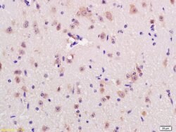 RNF123 Rabbit anti-Human, Polyclonal, Bioss 100 &mu;L; Unconjugated:Antibodies,