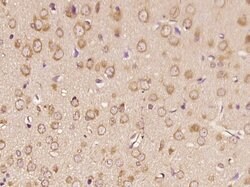 RNF170 Rabbit anti-Human, Polyclonal, Bioss 100 &mu;L | Buy Online | Bioss | Fisher Scientific