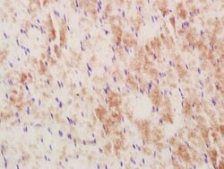 MUL1 Rabbit anti-Human, Polyclonal, Bioss 100 &mu;L | Buy Online | Bioss | Fisher Scientific