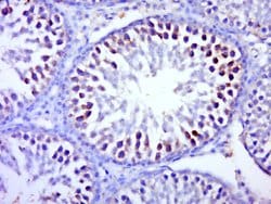 BTBD1 Rabbit anti-Human, Polyclonal, Bioss 100 &mu;L; Unconjugated:Antibodies,