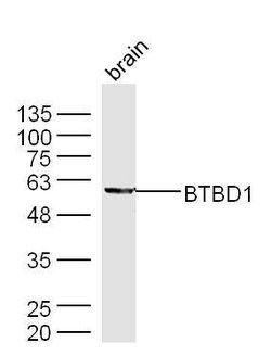 BTBD1 Rabbit anti-Human, Polyclonal, Bioss 100 &mu;L; Unconjugated:Antibodies,