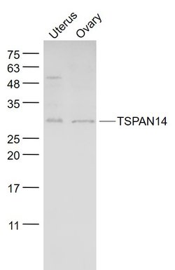 TSPAN14 Rabbit anti-Human, Polyclonal, Bioss 100 &mu;L; Unconjugated:Antibodies,