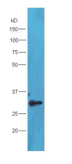 TXNDC9 Rabbit anti-Human, Polyclonal, Bioss 100 &mu;L; Unconjugated:Antibodies,