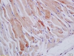 HSPB7 Rabbit anti-Human, Polyclonal, Bioss 100 &mu;L; Unconjugated:Antibodies,